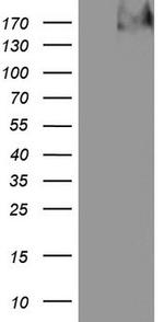TG Antibody in Western Blot (WB)