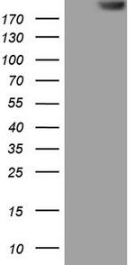 TG Antibody in Western Blot (WB)