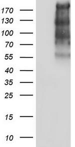 TG Antibody in Western Blot (WB)