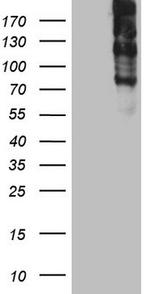 TG Antibody in Western Blot (WB)