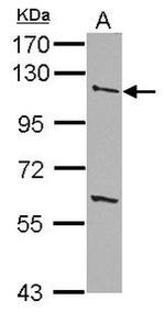 TGFBR3 Antibody in Western Blot (WB)