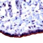 TGFBR3 Antibody in Immunohistochemistry (IHC)