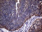 TGFBR2 Antibody in Immunohistochemistry (Paraffin) (IHC (P))