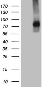 TGFBR2 Antibody in Western Blot (WB)