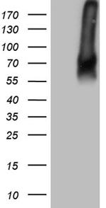 TGFBR2 Antibody in Western Blot (WB)