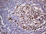 TGFBR3 Antibody in Immunohistochemistry (Paraffin) (IHC (P))