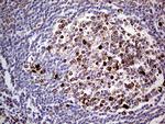 TGFBR3 Antibody in Immunohistochemistry (Paraffin) (IHC (P))