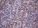 TGIF1 Antibody in Immunohistochemistry (Paraffin) (IHC (P))