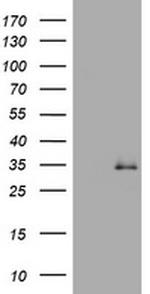 TGIF1 Antibody in Western Blot (WB)