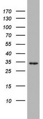 TGIF1 Antibody in Western Blot (WB)