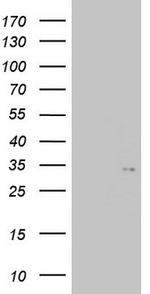TGIF1 Antibody in Western Blot (WB)
