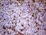 TGM2 Antibody in Immunohistochemistry (Paraffin) (IHC (P))