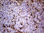 TGM2 Antibody in Immunohistochemistry (Paraffin) (IHC (P))