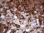 TGM2 Antibody in Immunohistochemistry (Paraffin) (IHC (P))