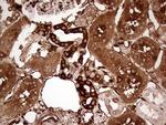 TGM2 Antibody in Immunohistochemistry (Paraffin) (IHC (P))