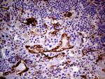 TGM2 Antibody in Immunohistochemistry (Paraffin) (IHC (P))