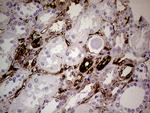 TGM2 Antibody in Immunohistochemistry (Paraffin) (IHC (P))