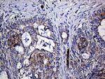 TGM2 Antibody in Immunohistochemistry (Paraffin) (IHC (P))