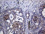 TGM2 Antibody in Immunohistochemistry (Paraffin) (IHC (P))
