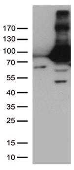 TGM2 Antibody in Western Blot (WB)