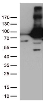 TGM2 Antibody in Western Blot (WB)