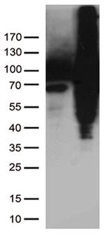 TGM2 Antibody in Western Blot (WB)