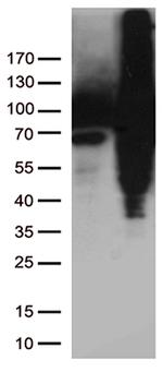 TGM2 Antibody in Western Blot (WB)