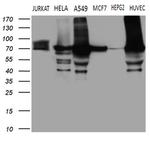 TGM2 Antibody in Western Blot (WB)