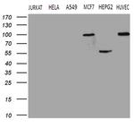 TGM2 Antibody in Western Blot (WB)