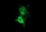 TH Antibody in Immunocytochemistry (ICC/IF)