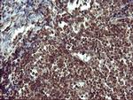 TH Antibody in Immunohistochemistry (Paraffin) (IHC (P))