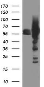 TH Antibody in Western Blot (WB)