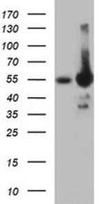TH Antibody in Western Blot (WB)