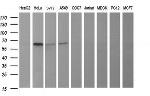 TH Antibody in Western Blot (WB)
