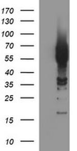TH Antibody in Western Blot (WB)