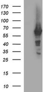 TH Antibody in Western Blot (WB)