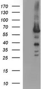 TH Antibody in Western Blot (WB)