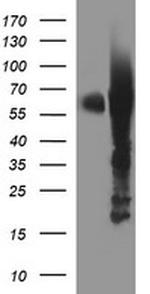 TH Antibody in Western Blot (WB)