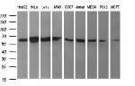 TH Antibody in Western Blot (WB)