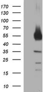 TH Antibody in Western Blot (WB)