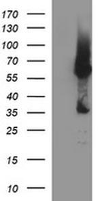 TH Antibody in Western Blot (WB)