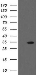 THAP6 Antibody in Western Blot (WB)