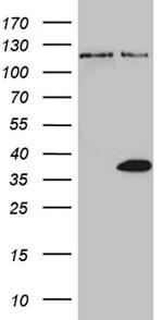 THAP8 Antibody in Western Blot (WB)