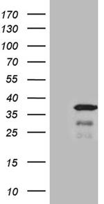 THAP8 Antibody in Western Blot (WB)