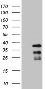 THAP8 Antibody in Western Blot (WB)