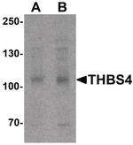Thrombospondin 4 Antibody in Western Blot (WB)