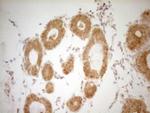 THRA Antibody in Immunohistochemistry (Paraffin) (IHC (P))