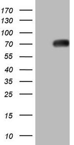 THRA Antibody in Western Blot (WB)
