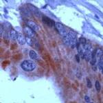 THRB Antibody in Immunohistochemistry (IHC)