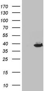 THTPA Antibody in Western Blot (WB)